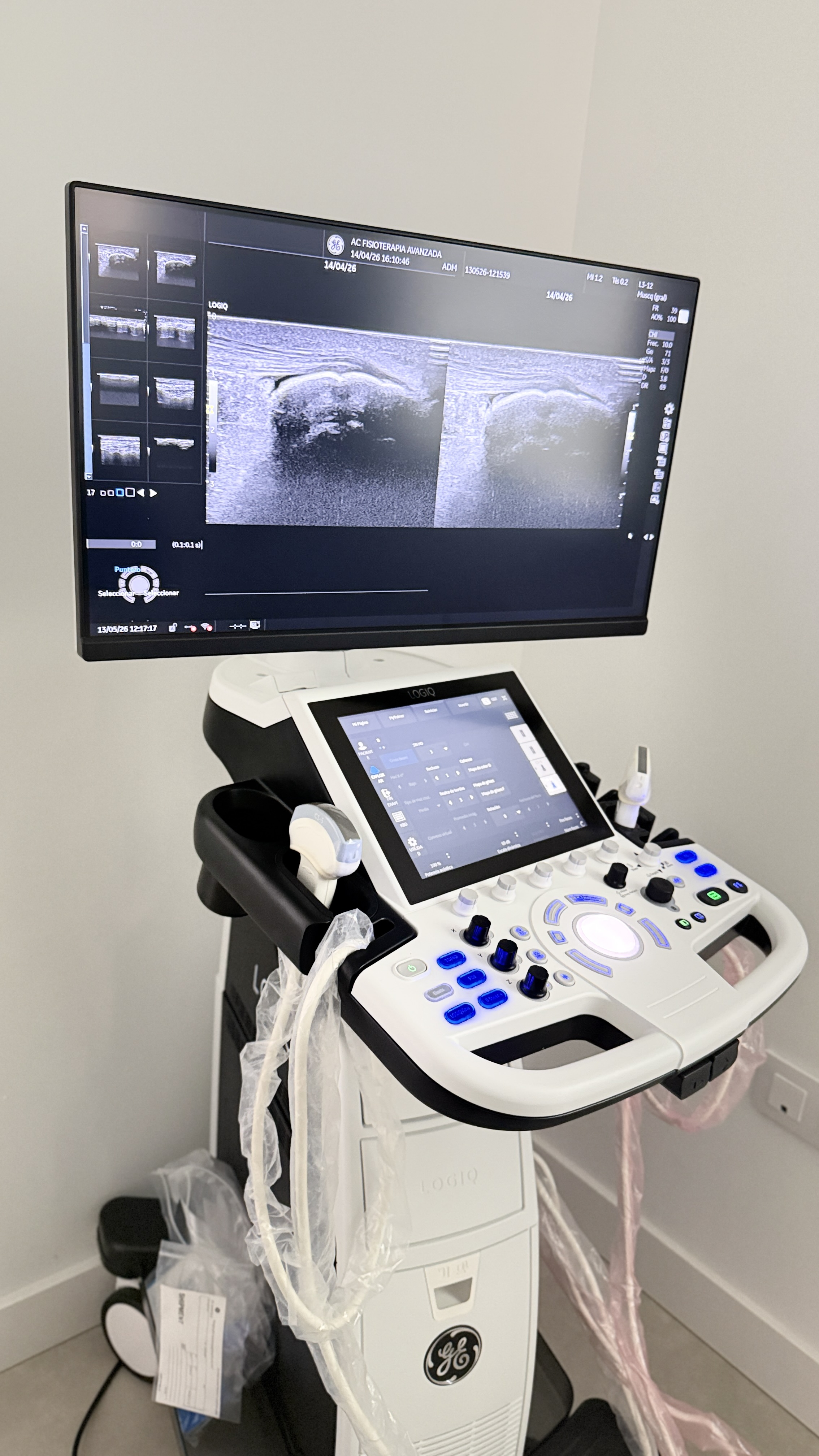 GE Logiq Ecógrafo — AC Fisioterapia Avanzada Sevilla
